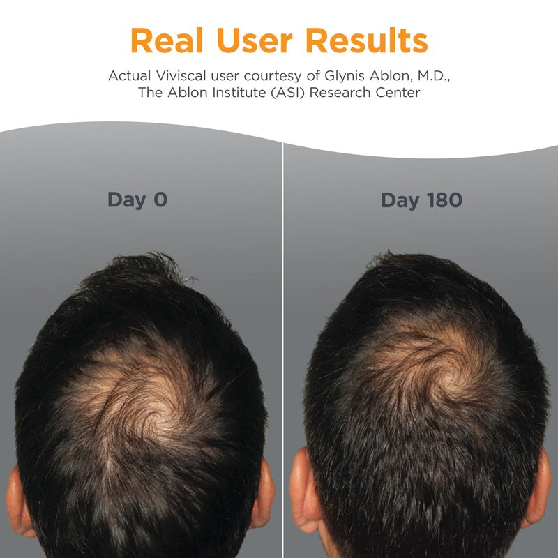 Viviscal Men's Hair Growth Supplements for Thicker Fuller Hair, Clinically Proven Collagen Complex, 60 Tablets 1 Month Supply