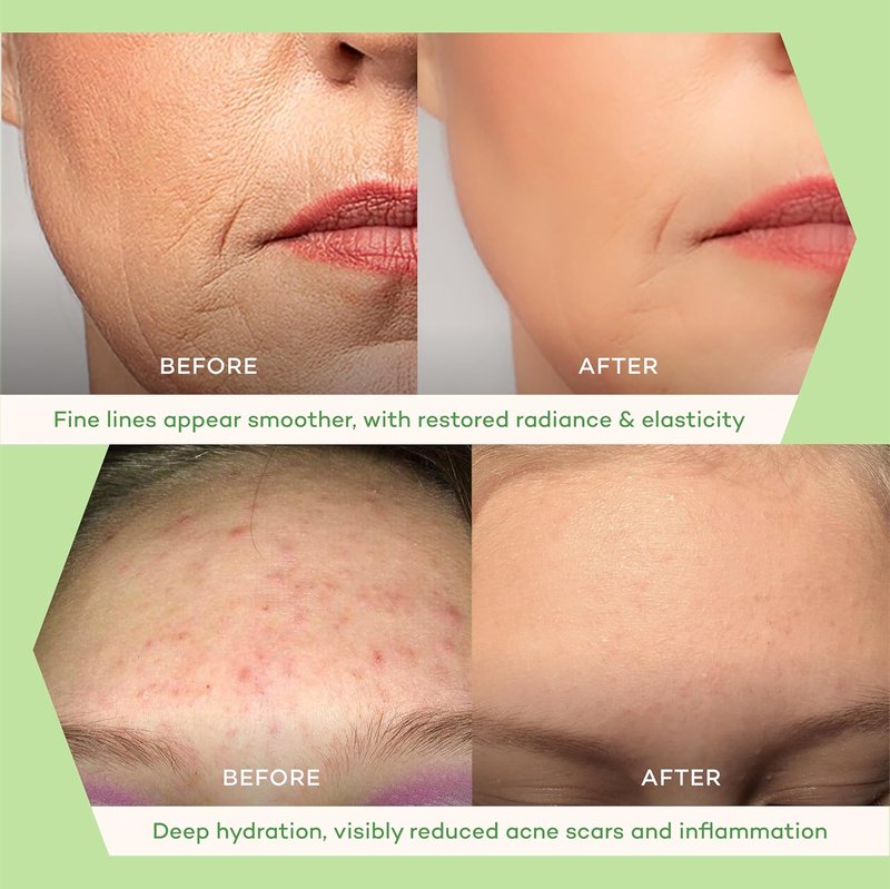 Eternity Facial Serum - Oil-Based Vitamin C Alternative for Women | Non-Greasy with Squalane, Sea Buckthorn & Nordic Microbes - 20ml