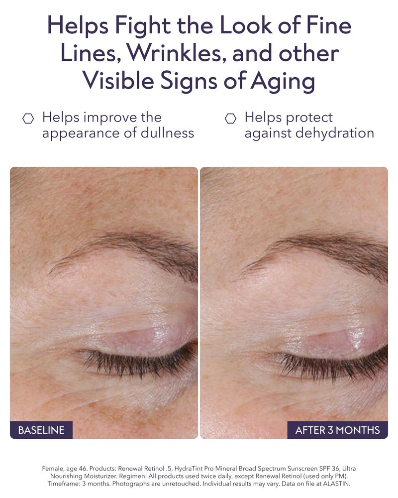ALASTIN Skincare Renewal Retinol Serum (.5 Strength, 1.0 oz) | Visibly Improves Skin Texture & Tone | Helps Reduce the Look of Fine Lines & Wrinkles | Hydrating Retinol Formula