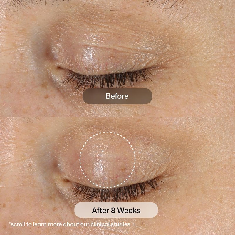 Revision Skincare D·E·J Eye Cream®, Clinically Proven to Reduce Under-Eye Fine Lines and Wrinkles with Peptides and Hyaluronic Acid for a Firmer, Smoother Eye Area, 0.5 fl oz