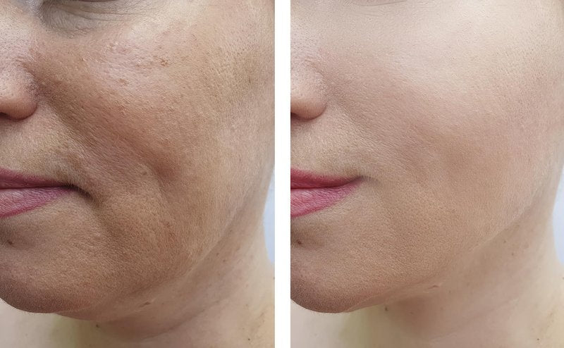 Vitality Precision Skin Retinol Peel Pads .5%- 3 month supply