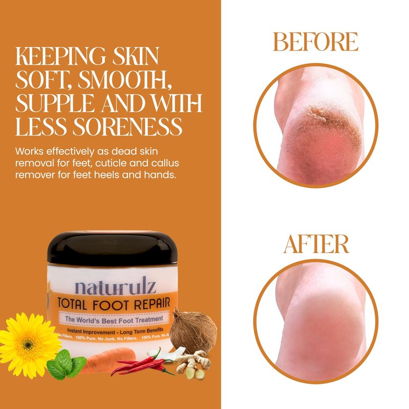 Naturulz Total Foot Repair 4oz – Intensive Moisture Foot Cream for Extremely Dry, Rough Skin & Cracked Heels and Feet- Moisture Barrier Repair for Knees, Elbows & Hands Formulated for Sensative Skin