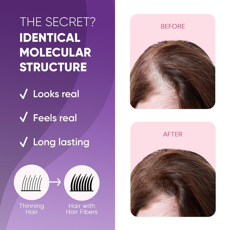 Hair Fibers for Thinning Hair & Bald Spots - Instant Cover Up & Volume | 25g White Powder for Men & Women