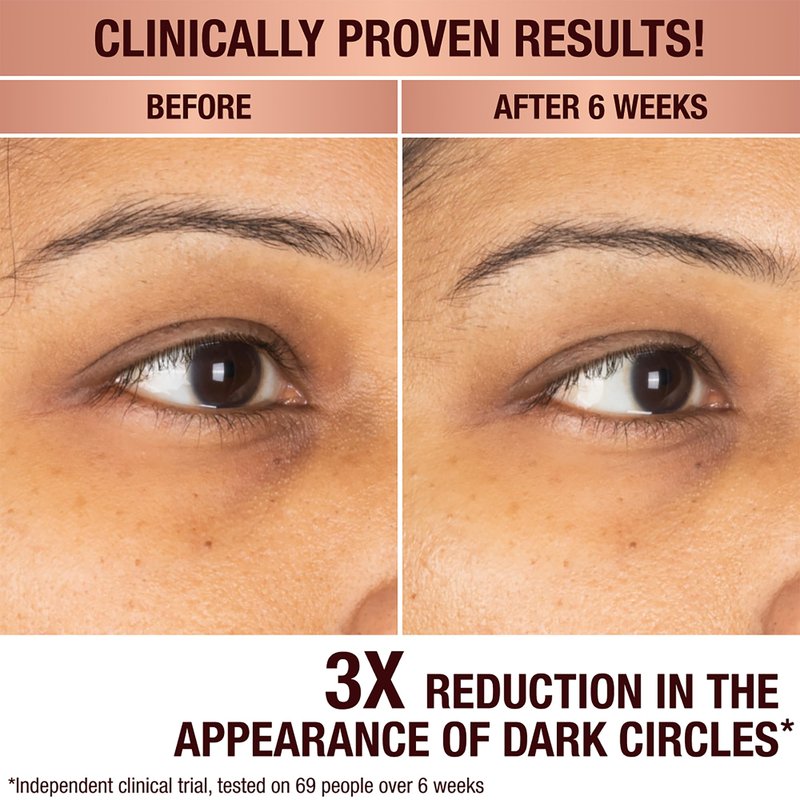 Charlotte Tilbury Radiance Recovery Dark Spot Serum - Tranexamic Acid & Vitamin C Serum for Brighter Looking Under Eyes, Redness, Uneven Skin Tone - Treatment to Reduce Appearance of Aging Skin (10ml)