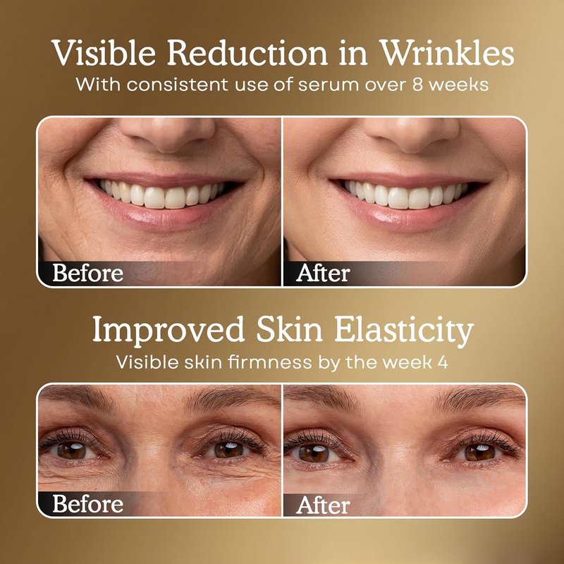 Anti-Aging Serum with Matrixyl 3000 & Hyaluronic Acid - Deep Wrinkle Repair & Hydration | 1.01 Fl Oz