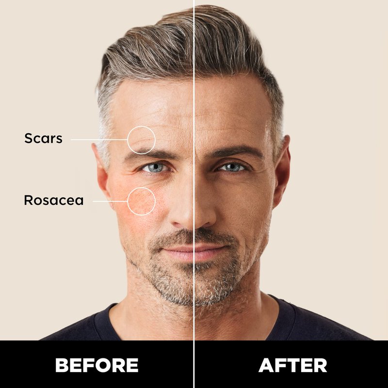 Stryx Concealer Stick Tool for Men, Medium Mahogany - Natural Pigments Hides Imperfections, Acne, Razor Burns, Scars, & Rosacea - Highly Adaptable Shades for Easy, Undetectable Coverage