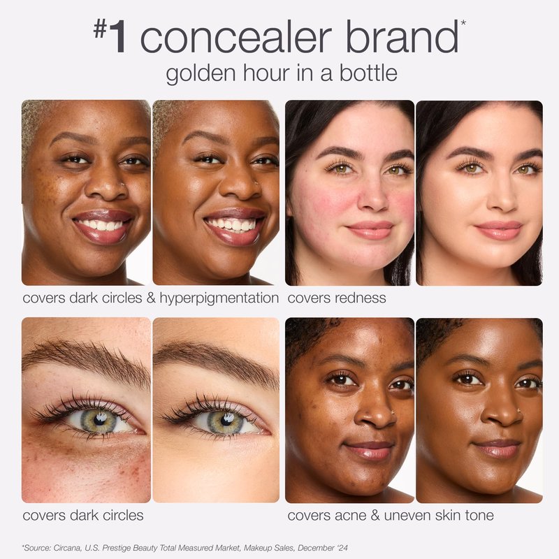 tarte shape tape radiant concealer – Medium-Coverage, Hydrating Finish Under Eye Concealer for Dark Circles, Redness & Discoloration, Vegan, Cruelty-Free, full size, 37G medium-tan golden