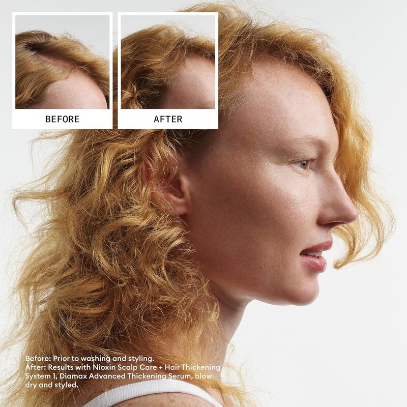 Nioxin Scalp & Hair Thickening Shampoo - Natural Hair Care | Strengthens Against Breakage with Niacinamide & Biotin