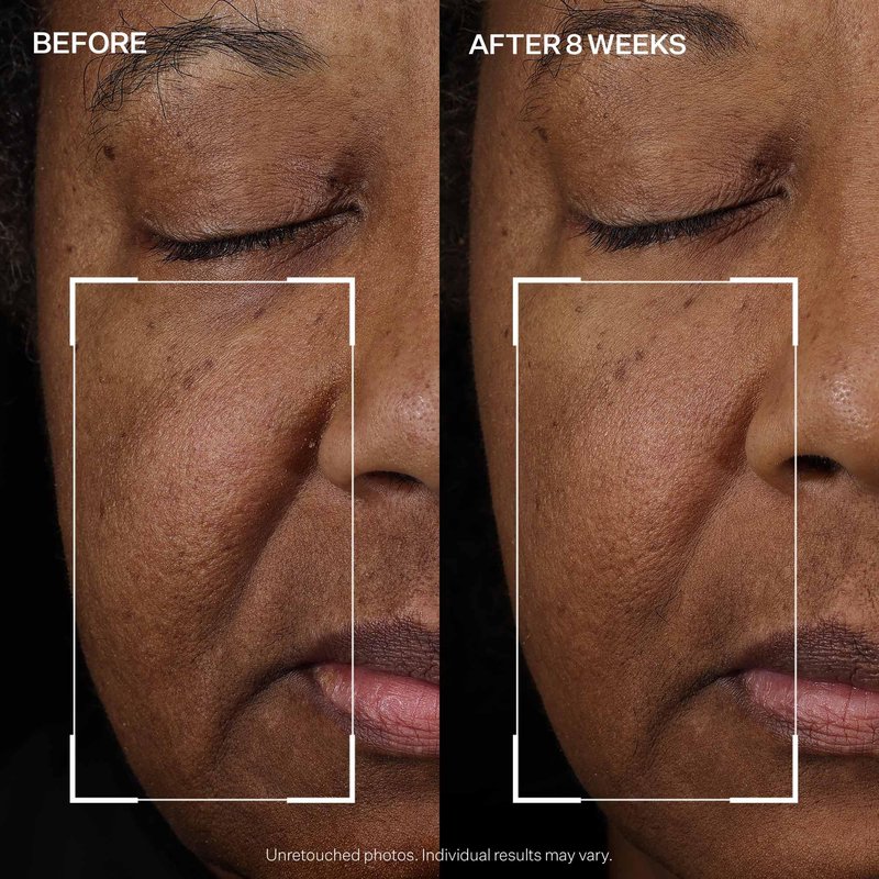StriVectin Tighten and Lift Peptight Face Lift Serum with Tightening and Brightening Peptides for Wrinkles, Under Eye Bags and Puffiness, 30 mL