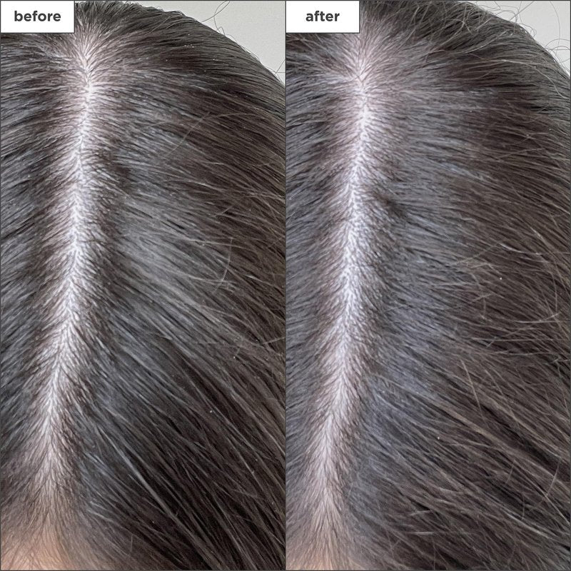 Briogeo Scalp Revival Charcoal + Biotin Dry Shampoo | Non-Aerosol Powder for Oily Roots | Detoxifying Dry Shampoo for All Hair Types | Vegan & Cruelty Free | 1.7 oz.