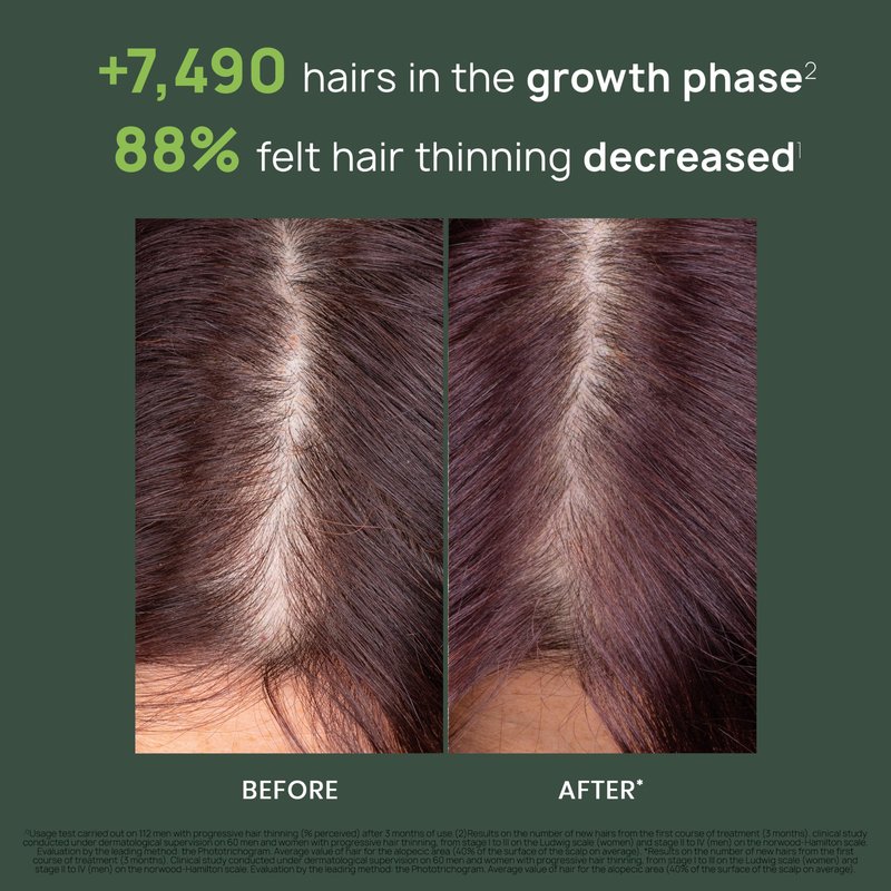 Rene Furterer TRIPHASIC Progressive Concentrated Serum, Thinning Hair Suitable for those Experiencing Hereditary & Hormonal Thinning, Drug Free Hair Thickening Serum, Energize Scalp, Hair Health